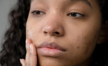 Skin Conditions: What You Want to Be aware