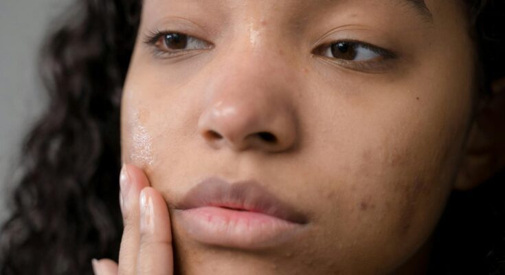 Skin Conditions: What You Want to Be aware